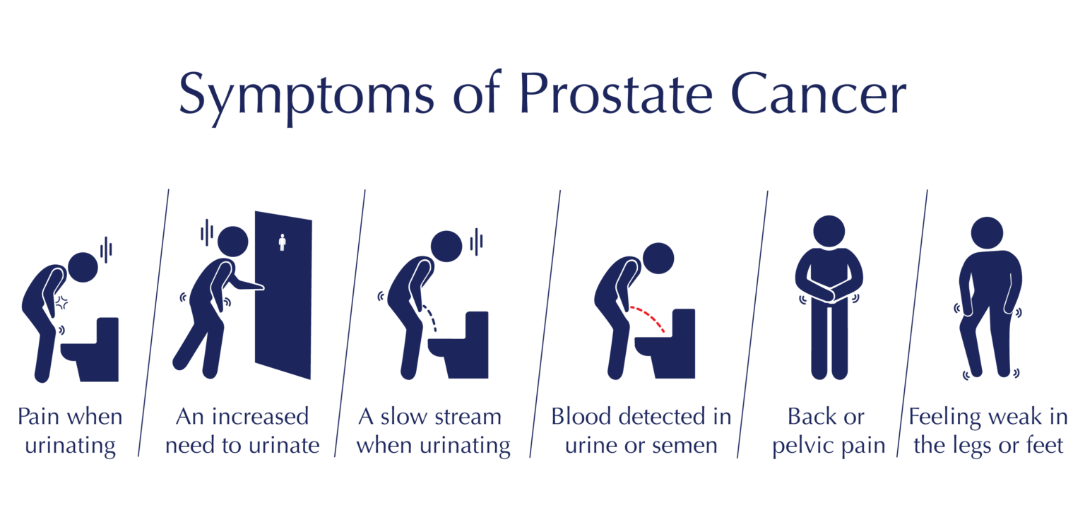 Side Effects Of Prostate Removal